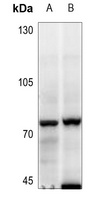 MELK antibody