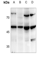 TANK antibody