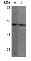 ANGPTL7 antibody