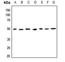 Anti-ACOT2 Antibody