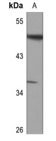 ATF7 antibody