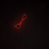 AKAP10 Rabbit Polyclonal Antibody