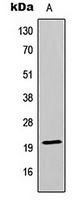 Anti-MRPL13 Antibody