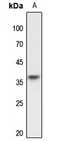 TRA2A antibody