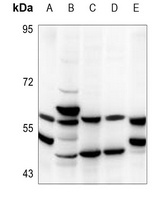 Anti-TBX22 Antibody