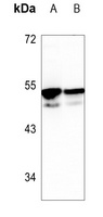 CDKL3 antibody