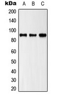 Anti-ZAK Antibody