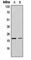 MRPL17 antibody