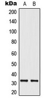 ELOVL1 antibody