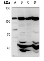 Anti-CARD14 Antibody