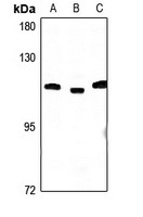 CCP2 antibody