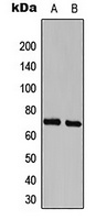 Anti-CDK5RAP3 Antibody