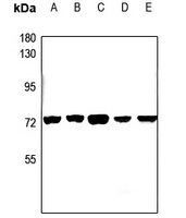 Anti-CEP70 Antibody