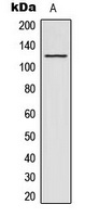 Anti-ACAD10 Antibody