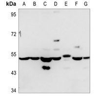Anti-ADPGK Antibody