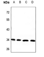 CEACAM21 antibody