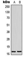 BTF3L4 antibody