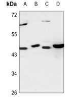 Anti-CEP41 Antibody