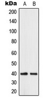 Anti-ABHD12B Antibody