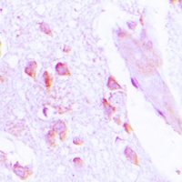 ABHD12B Rabbit Polyclonal Antibody