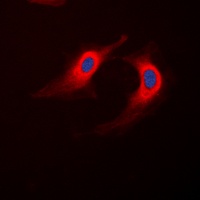 ABHD12B Rabbit Polyclonal Antibody