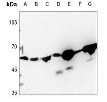 Anti-DQX1 Antibody