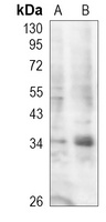 STING antibody