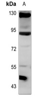Anti-ANKRD20A3 Antibody