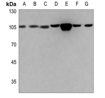 Anti-ACTN1/2/3/4 Antibody