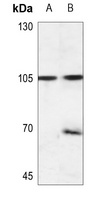 EEF2K (phospho-S366) antibody