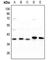Anti-CK1 alpha Antibody