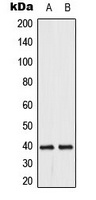 DUSP1/4 antibody