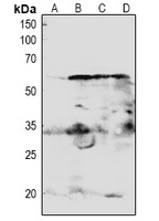 Anti-AKT Antibody