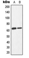 Anti-AMPK alpha 1/2 (Phospho-T183/172) Antibody