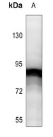 Anti-STAT5 (Phospho-Y694/699) Antibody