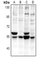 CaMK2 alpha/delta antibody