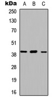ABHD13 Rabbit Polyclonal Antibody