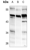 AChE Q antibody