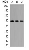 Anti-AF3P21 Antibody