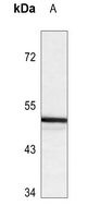 ANGPTL3 antibody