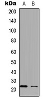 Anti-APOBEC3C Antibody