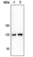 ARHGAP20 antibody