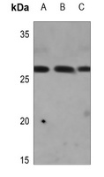 Anti-CAPNS2 Antibody