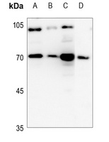 Cathepsin C LC Rabbit Polyclonal Antibody