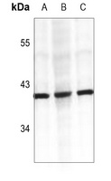 Cathepsin K antibody