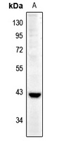 Cathepsin W antibody