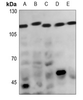 Anti-CATSPER1 Antibody