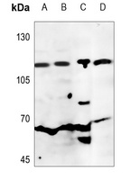 Anti-CD26 Antibody
