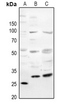 Anti-CD354 Antibody