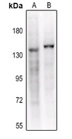 CD41 HC antibody